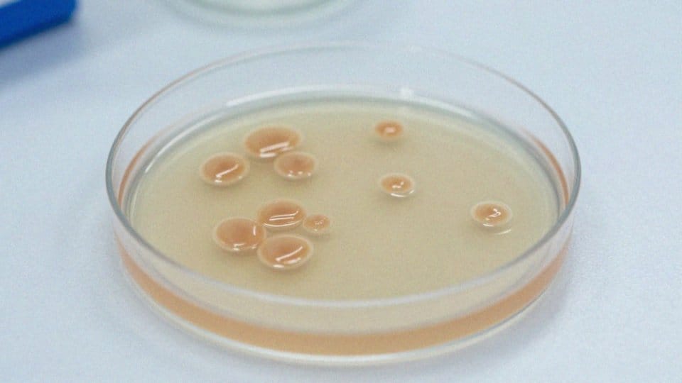 Jak interpretować posiew moczu z Klebsiella pneumoniae?