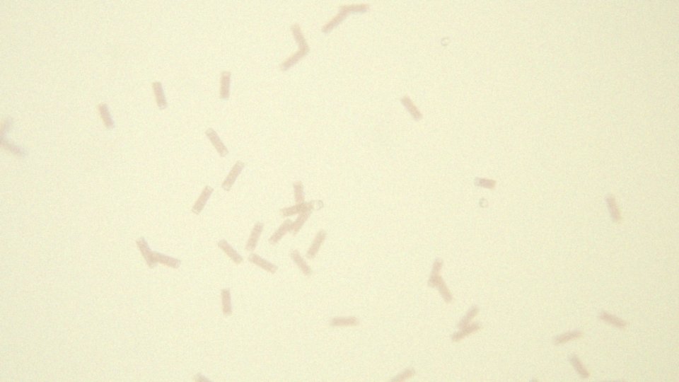 Lactobacillus spp. – co to jest i jakie ma korzyści zdrowotne?